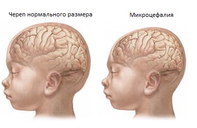 елена малышева про паразитов внутри организма елена малышева про паразитов внутри организма